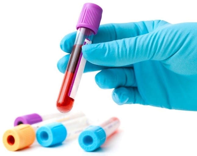 Biofluids Biofluids